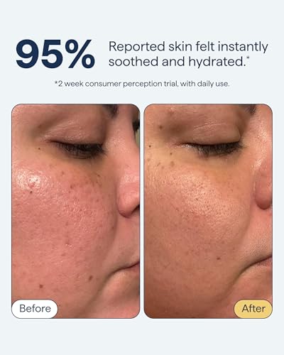 Remedy Lightweight Gel Moisturizer with Niacinamide & Ceramide - 1.7 oz