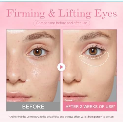 KOEC Bomb Lifting Eye Gel with Retinol, Collagen Extract, Niacinamide, Mentha Arvensis Leaf, Anti-Aging Under Eye Treatment for Dark Circles and Fine Lines