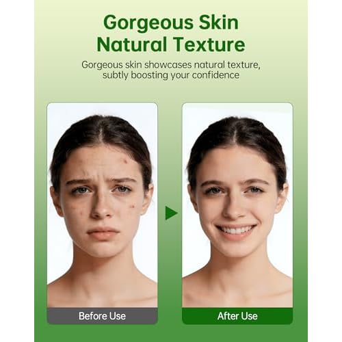 Azelaic Acid Cream for Face: Redness-Soothing Azelaic Acid Facial Cream for Uneven Tone, Blemish-Prone Skin, Pore Care and Skin Clarity Support, 1 oz