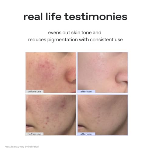 glow mini Lemon Vitamin Toner | Hydrating with hyaluronic Acid | mild Exfoliation | Jeju Lemon Water for Refreshing deep?Moisture | Highly Absorbent Formula | Cruelty?Free | 1 fl oz