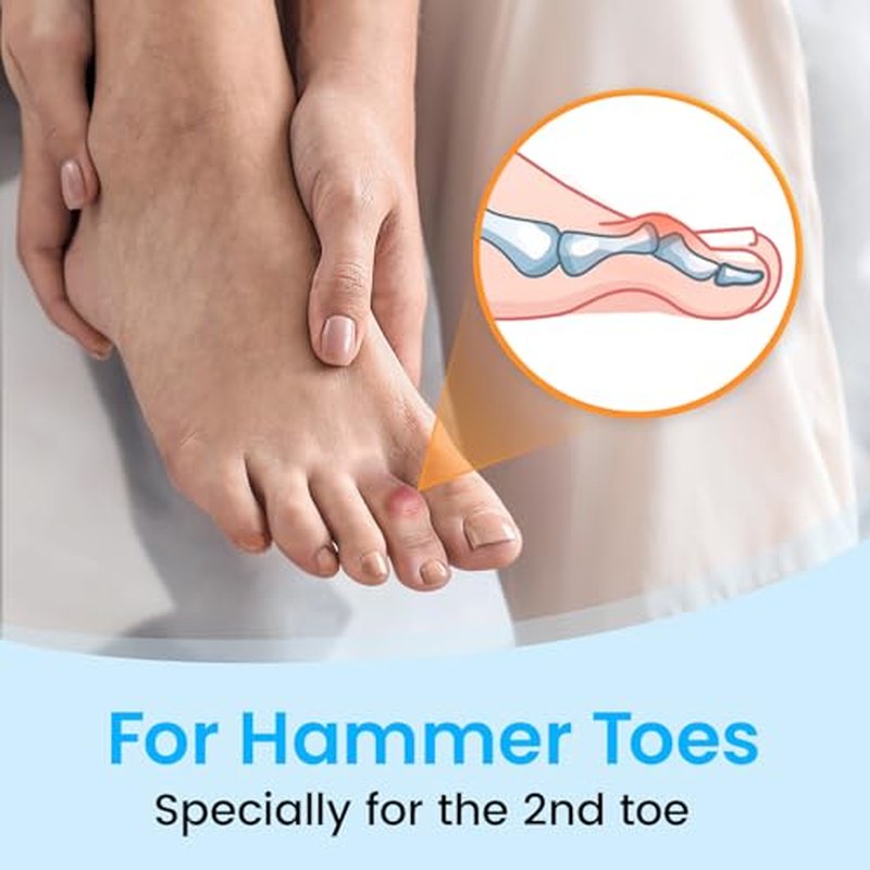 Hammer Toe Straightener for Men & Women - 2-Pack Splint Support