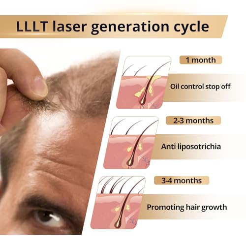 Hair Growth Device with Laser Red Light Therapy - Rechargeable LLLT