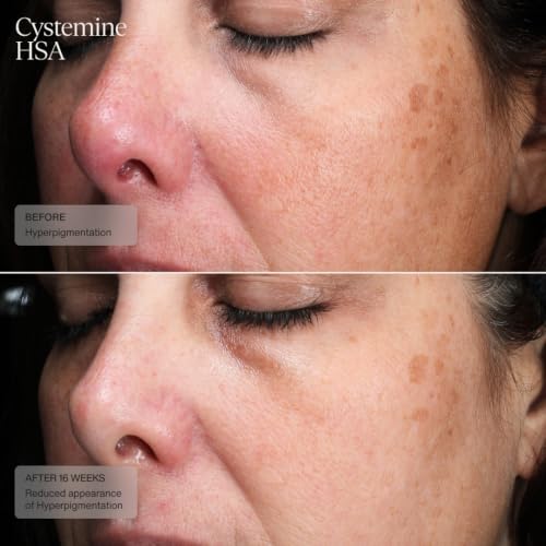 Senté Cysteamine HSA Dark Spot Corrector Cream - 1.7 Fl Oz