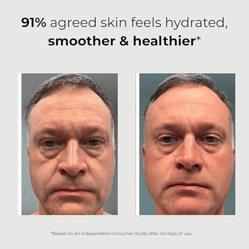 ABERA Men 6-in-1 Retinol Serum for Face, Melasma Treatment with Niacinamide & Hyaluronic Acid, Reduces Fine Lines, Wrinkles, Dark Spot Remover, Evens Tone with Aloe & Centella Asiatic (Pack of 2)
