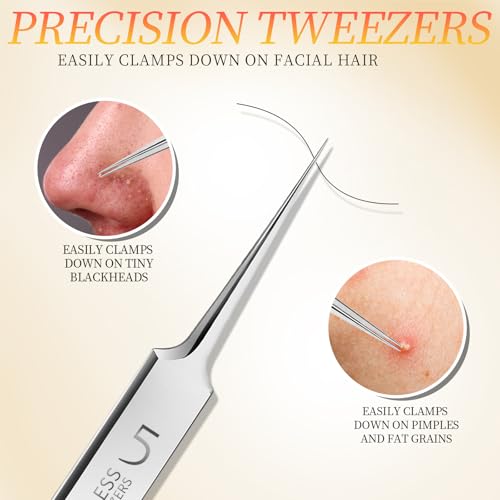 Blackhead Pimple Remover Tweezers Kit - 4 Stainless Steel Precision Tools