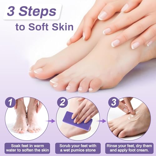 RAQEHO 10-Pack Dual-Sided Foot Pumice Stone for Callus & Hard Skin