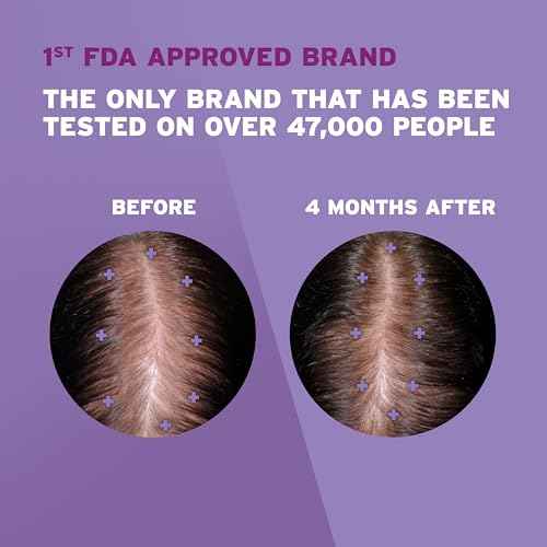 Women's Rogaine 2% Minoxidil Topical Solution for Hair Thinning and Loss, Topical Treatment for Women's Hair Regrowth, 3-Month Supply