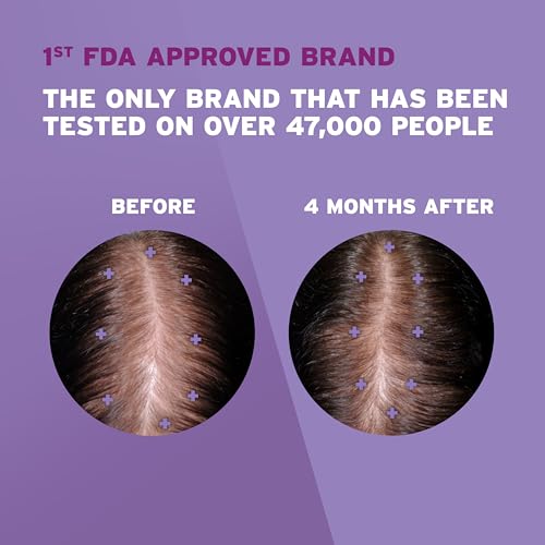 Women's Rogaine 2% Minoxidil Hair Regrowth Solution, 3-Month Supply
