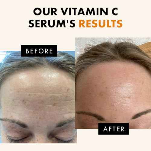 Eclat Skincare Vitamin C Face Serum - Skin Care for Dark Spots, Vitamin C Serum with Hyaluronic Acid, Ferulic Acid, & Vit E - Anti Aging and Skin Brightening, Vit C Face Care 1 Fl Oz