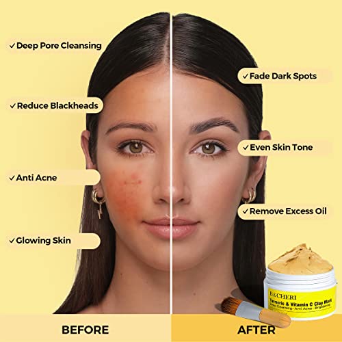 Turmeric Vitamin C Clay Mask # 130g, Blackheads Acne Dark Spots Remover with Turmeric Extract, Glowing Skin, Refining Pores and Controlling Oil