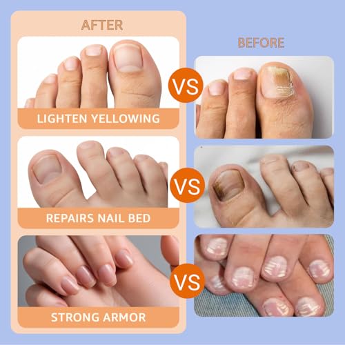 Nail Care Patches - 21 PCS Overnight Toenail Repair for Healthy Nails