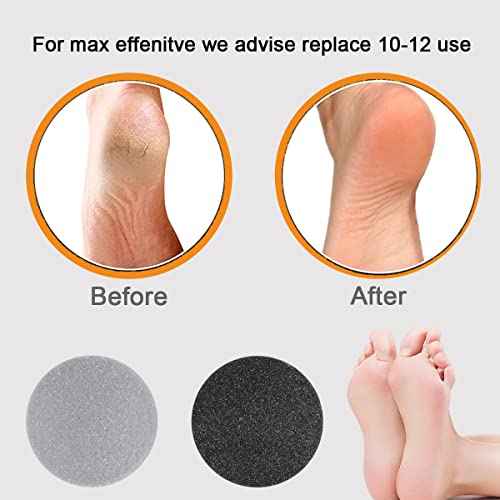 25 Pack Replacement Pads Refills for Pedi Vac Portable Electric Vacuum Callus Remover Foot File for Exfoliation Cracked Heels Dead Skin with a Clean Brush (20pcs Grind Head Pads +5pcs Sponge Ring)