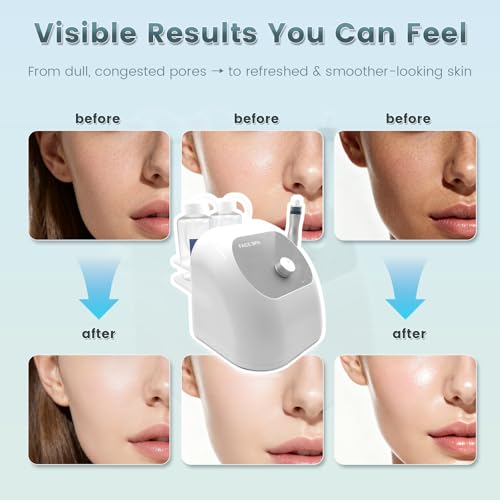 Hydrogen Oxygen Hydro Facial Machine for Home Skincare