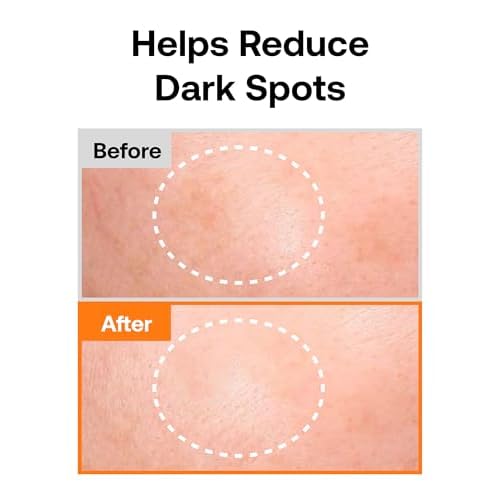 Mela-fade Infused Gotgam Toning Serum, Korean Natural Facial Serum With Vitamin C, Hydrating and Soothing for Dark Spots, Sensitive Skin, Highly-Concentrated Korean Skin Care, 1.52 Fl Oz