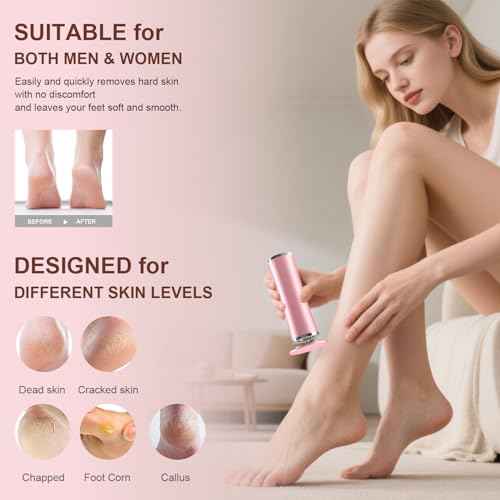 10-in-1 Electric Foot Callus Remover, Adjustable Speed Electric Callus Remover for Feet with 60 Sanding Pads, Foot Callus Remover, Heel Scraper for Cracked Heels (Rose Pink)