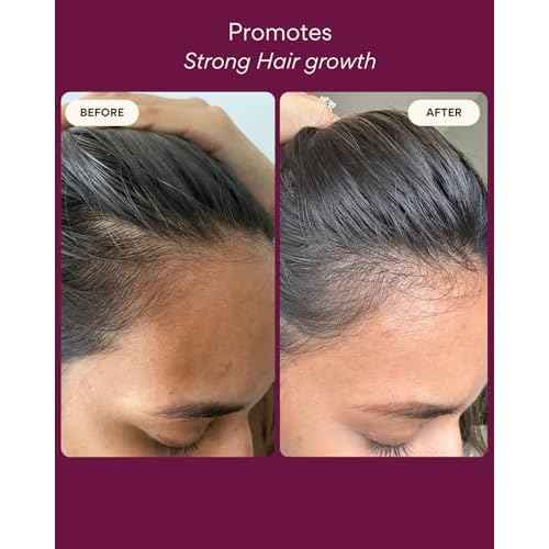 Hair Growth Oil | Natural Hair Regrowth Rosemary Oil for Hair Growth | Scalp & Hair Loss Treatment for Dry, Damaged Hair for Women & Men, 100 ml