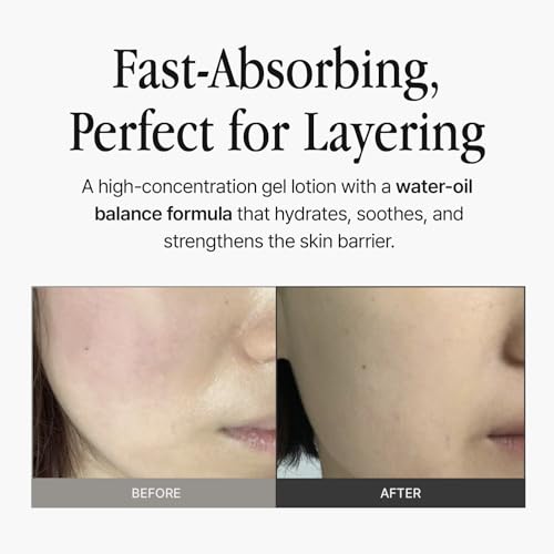 Gelmoisture 1.01 fl oz (30ml) ? Lightweight Hydrating Gel Lotion with Witch Hazel & Multi-Layer Moisture System for Daily Skin Hydration