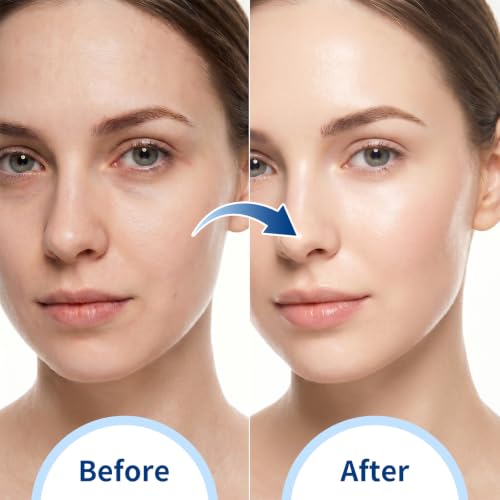 Gel Eye Mask & Cooling Face Mask - Hot/Cold Therapy for Puffiness