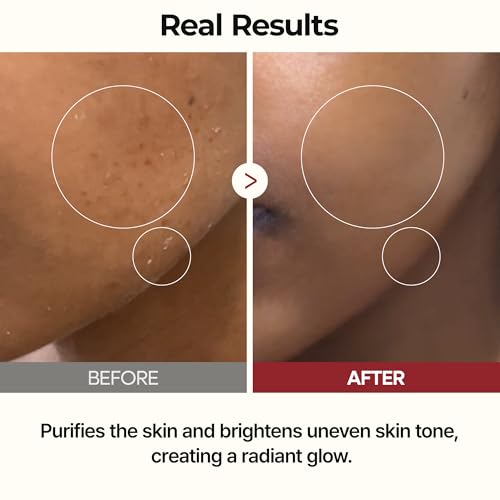 Dr.Melaxin Rice Toner with Ceramides & Liposome Oil 6.76oz