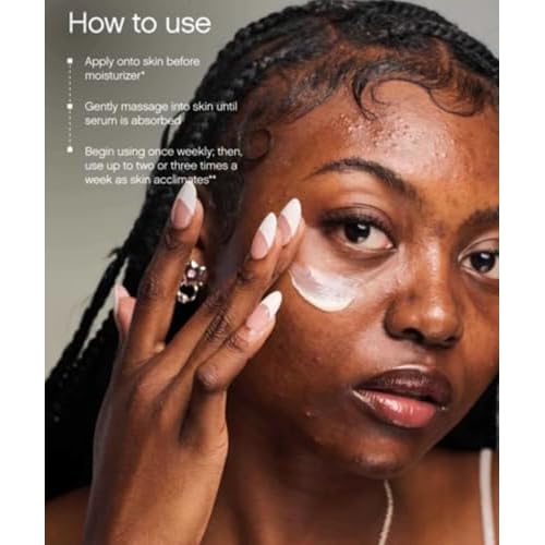 Topicals Faded Brightening and Clearing Serum | Reduces Discoloration, Post-Blemish Marks, Scars and Spots | Contains Kojic Acid and Niacinamide | Dermatologist-tested, Vegan, Cruelty-Free (1.7 Fl Oz)