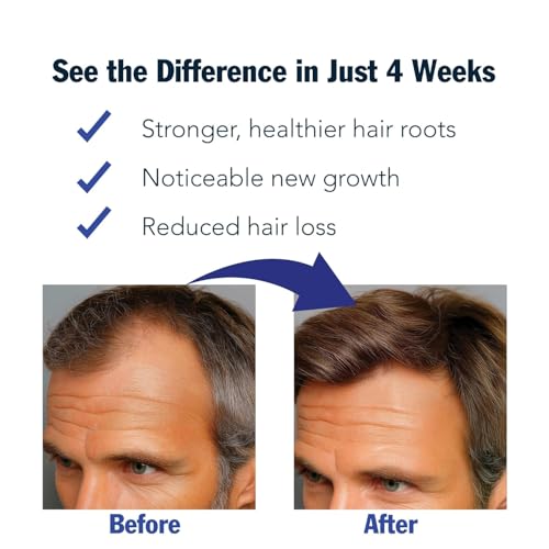 Rosemary Oil Hair Growth Serum Roll-On with Redensyl - 30ml
