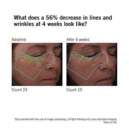 NEOVA SmartSkincare DNA Total Repair Serum 30 mL, 1 fl. Oz. | Reduces Wrinkles, Uneven Texture, & Hyperpigmentation | Sun Damage Repair Serum