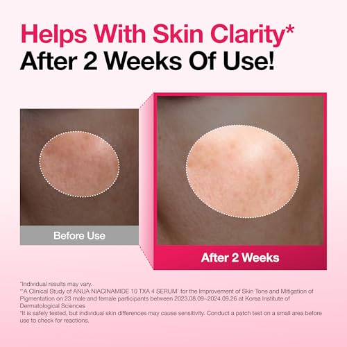 Anua Niacinamide 10% + Tranexamic Acid Serum for Dark Spots