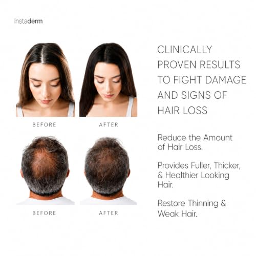 Hair Growth Serum for Thinning Hair – Peptide & Botanical Treatment