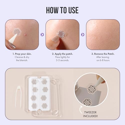 Magnesium Blemish Microdarts | Pimple Patch | Fast-Acting | Quick Calming | 99.9% Pure Magnesium | Madecassic Acid | Tea Tree | Eucalyptus Leaf | Hydrocolloid Spot Care Patch