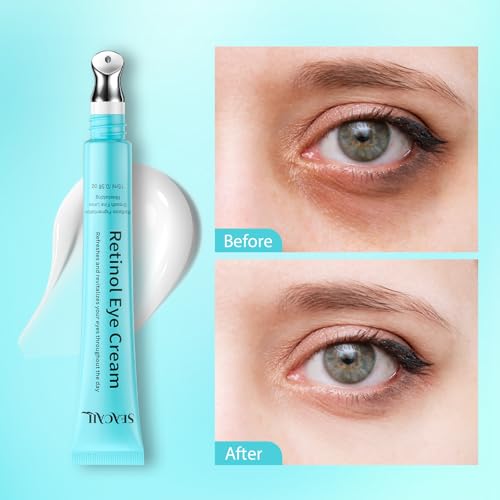 Retinol Eye Cream with Hyaluronic Acid & Caffeine, 15ml