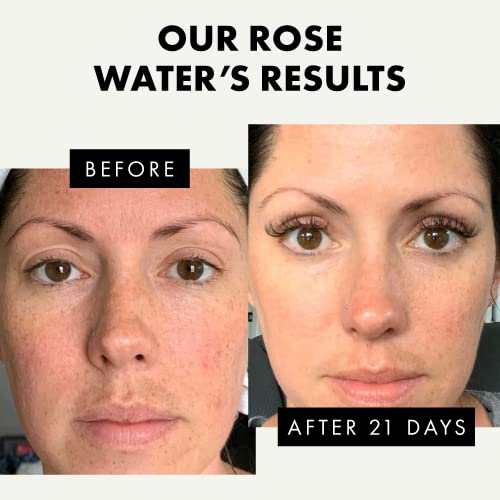 Eclat Skincare Unclog & Hydrate - Rose Water Toner and Hyaluronic Acid Serum - Combo Pack - 100% Vegan & Dermatologist Developed