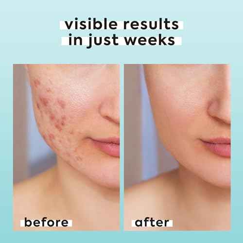 Hypochlorous Acid Spray for Face & Body - 3.4 fl oz 0.02% HOCL - Helps Reduce Redness and Breakouts - Travel Size Hypochlorous Spray - Multi-Purpose Topical Facial Skin Repair - pH-Balancing Toner