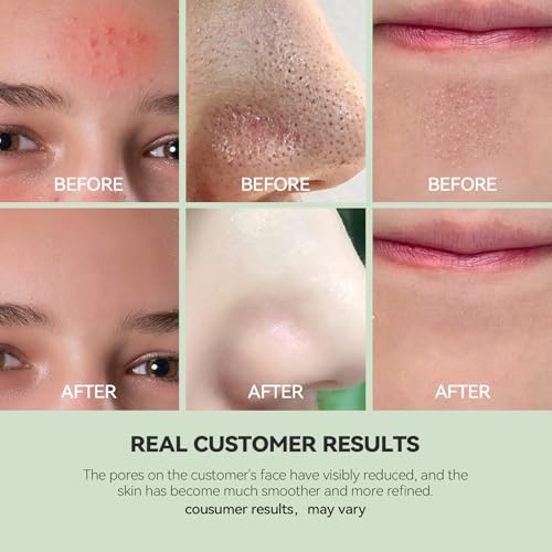 WNP Duo Cleansing Clay Mask with Niacinamide & Hyaluronic Acid ? Deep Pore Cleanser for T-Zone & U-Zone, Blackhead Remover, Hydrating & Oil-Control Face Mask, 3.53oz (Pack of 2)