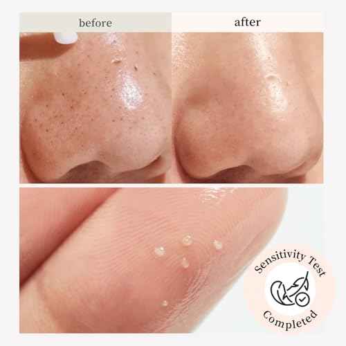 NOONI Korean Cleansing Oil - Snow Aqua 0 Ginseng Deep Cleansing Oil | Makeup Blackhead Remover, Pore Care Control, Glass Skin, Helps Control Sebum, Revitalizing Care, Stocking Stuffers, 6.76 Fl Oz