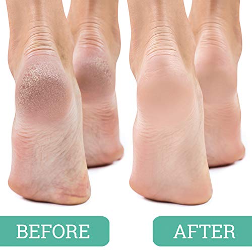 Maccibelle Salon Foot Pumice and Scrubber for Feet and Heels Callus and Dead Skins, Safely and Easily Eliminate Callus and Rough Heels (Pack of 1)