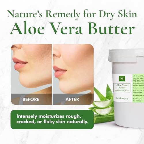 Aloe Vera Butter ?Hydration of Dry Skin Caused By Eczema, Psoriasis, Rosacea, Sun Burn, Wind Burn, and General Chapping 16 Oz
