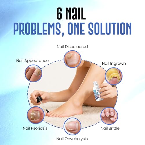 Miratiful Urea 50% Nail Gel for Thick Toenails & Calluses with Brush Applicator