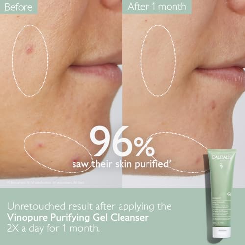 Caudalie Vinopure Salicylic Acid Cleanser, Pore Purifying Gel Cleanser - 150 mL (Pack of 2)