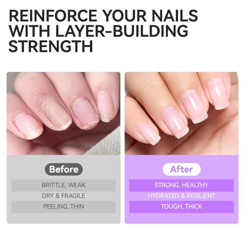 GELIKE EC 6-in-1 Nail Strengthener & Ridge Filler Treatment for Weak Nails