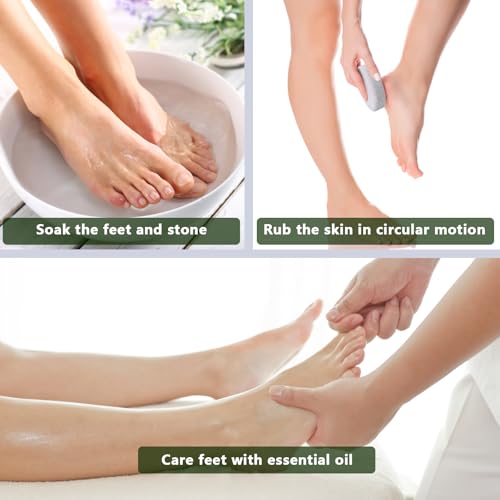 Borogo Natural Volcanic Pumice Stone Foot Callus Remover (4 Pack)