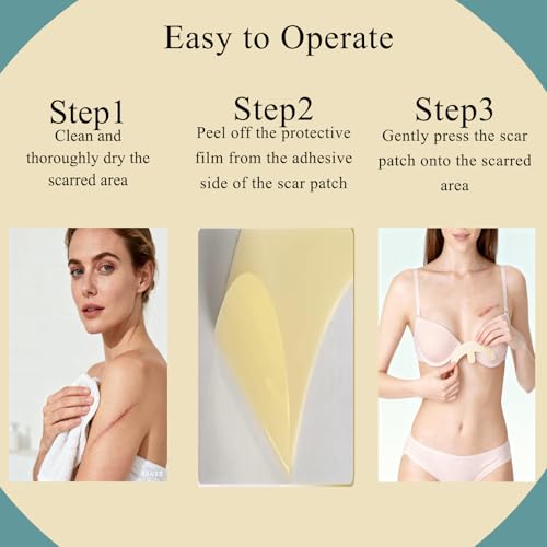 Scar Away Silicone Scar Sheets for Breast - 8 Pack (4 Areola + 4 Anchor) - Reusable for C-Section, Breast & Surgical Scars and Keloid Scars