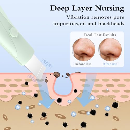 Skin Scrubber Face Spatula - Blackhead Remover & Pore Cleaner - Green