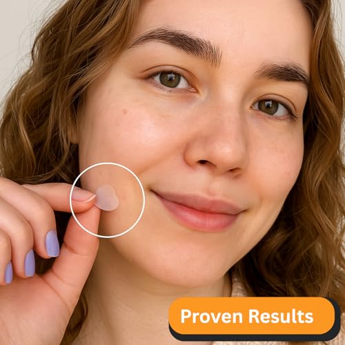 300 Pimple Patches ? Hydrocolloid Zit Stickers with Salicylic Acid, Tea Tree & Calendula | Helps Reduce Visible Blemishes ? Gentle, Overnight Skin Care