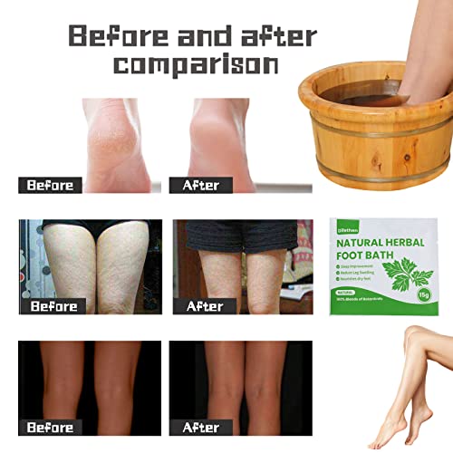 Difethen Herbal Mugwort & Ginger Foot Soak Bags for Swelling - 10 Pack