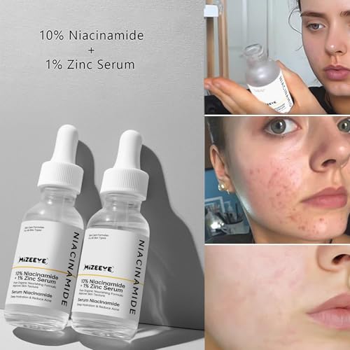 Niacinamide 10% + Zinc 1% Face Serum for Girls & Women, Moisturizing Niacinamide Serum for Acne, Redness.