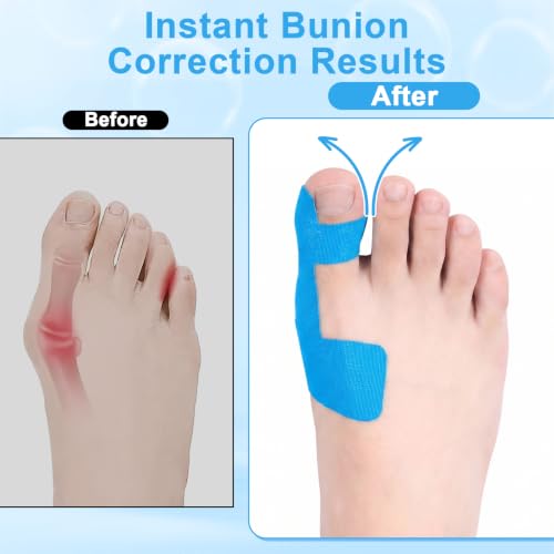 Bunion Corrector Tape for Big Toe - Ultra-Thin, Pre-Cut, Shoe-Friendly (20PCS)