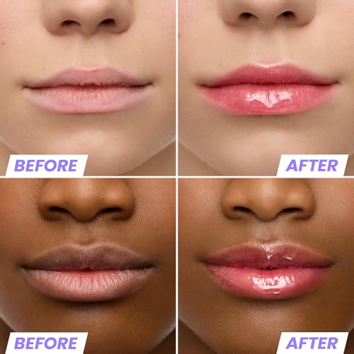 Wonderskin Lip Oil Rehab Serum - Tinted Hydrating Lip Oil - Amour