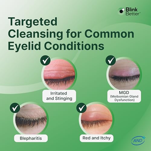 BetterLids Eyelid Cleansing Gel ? Gentle Centella & Tea Tree Extract Cleanser ? Refreshes & Cleanses for Daily Eyelid Care ? Preservative-Free ? 1.06 oz