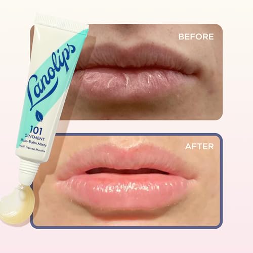 Lanolips 101 Ointment - Lanolin Lip Balm for Smooth, Hydrated & Healthy Lips - Multipurpose Lip Ointment with Lanolin Oil for Dry Lips, Cuticles & More - Peppermint (0.52 oz)