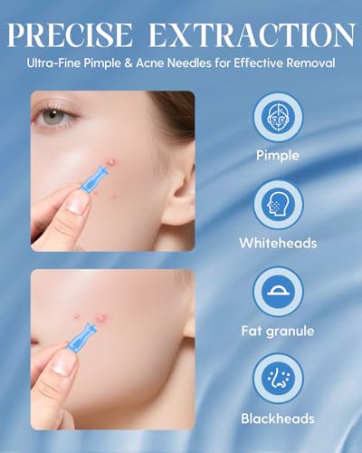 Disposable Acne Pimple Needles Set of 50 - Sterile Blackhead Extraction Tools with Twist Cap - Home & Salon Use